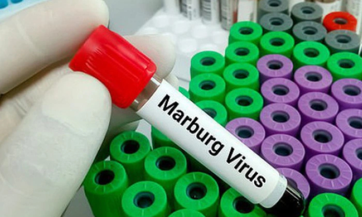 Nâng cao cảnh giác với bệnh do virus Marburg​