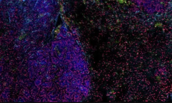 Phát hiện virus cổ đại có thể giúp điều trị ung thư phổi