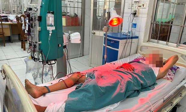 Ngộ độc rượu tại đám tang khiến 1 người tử vong, 5 người cấp cứu: Thêm nạn nhân nhập viện lọc máu