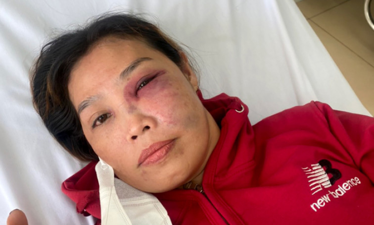 Bà chủ quán mì bị khách đánh túi bụi