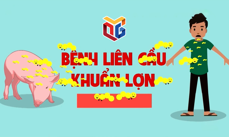 Dấu hiệu nhận biết bệnh liên cầu lợn ở người