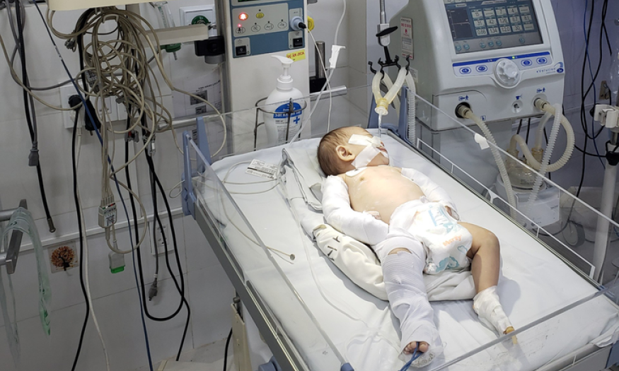 Trẻ 3 tháng tuổi bị mẹ và cha dượng hành hạ đến gãy xương