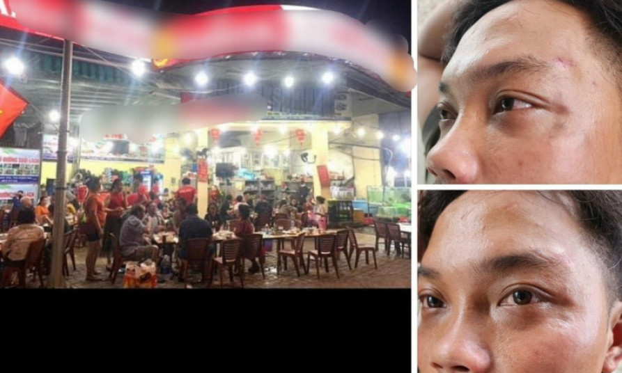 4 nhân viên quán hải sản đánh người rồi khai... nhầm