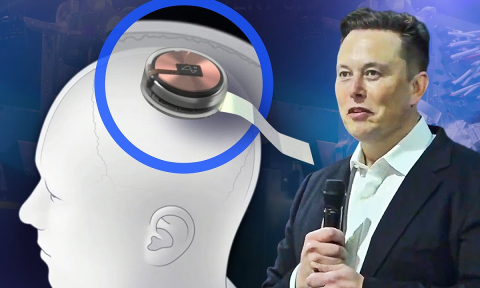 Chip não chữa bệnh của Elon Musk hoạt động như thế nào trong não người