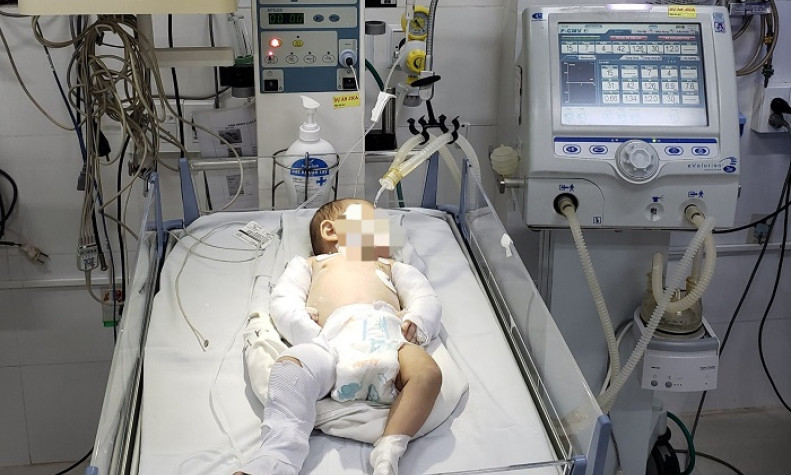 Bé gái hơn 2 tháng tuổi bị bạo hành dã man được xuất viện