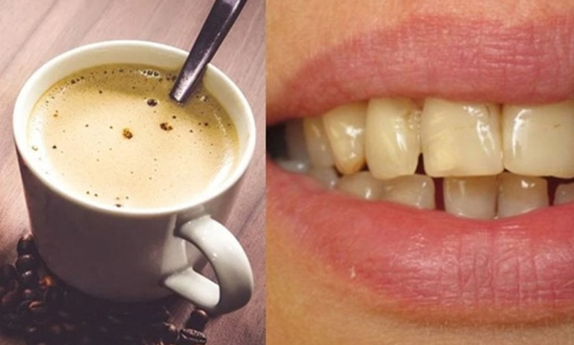 Cách uống cà phê giúp bảo vệ răng miệng