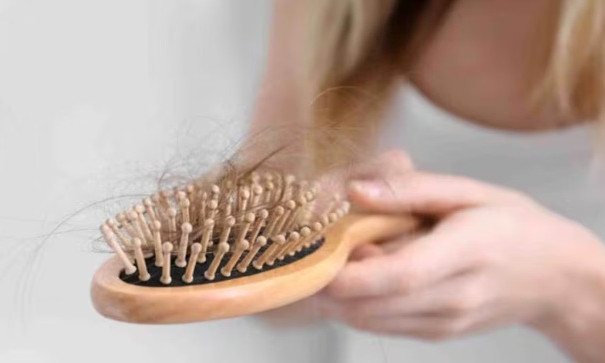 Mắc bệnh đái tháo đường có gây rụng tóc không?