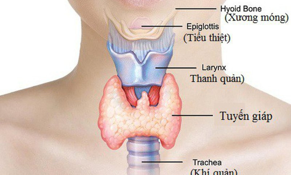 Những bệnh khiến bạn khó giảm cân