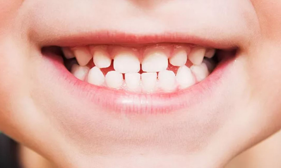 Phát triển loại thuốc giúp răng mọc lại nhiều lần