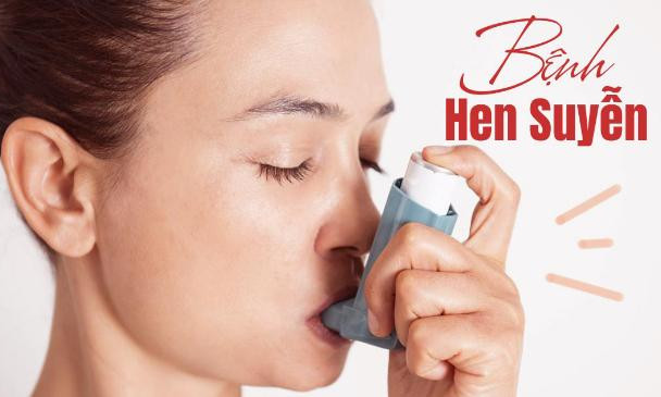 Người bệnh hen có phải kiêng đồ ăn tanh?