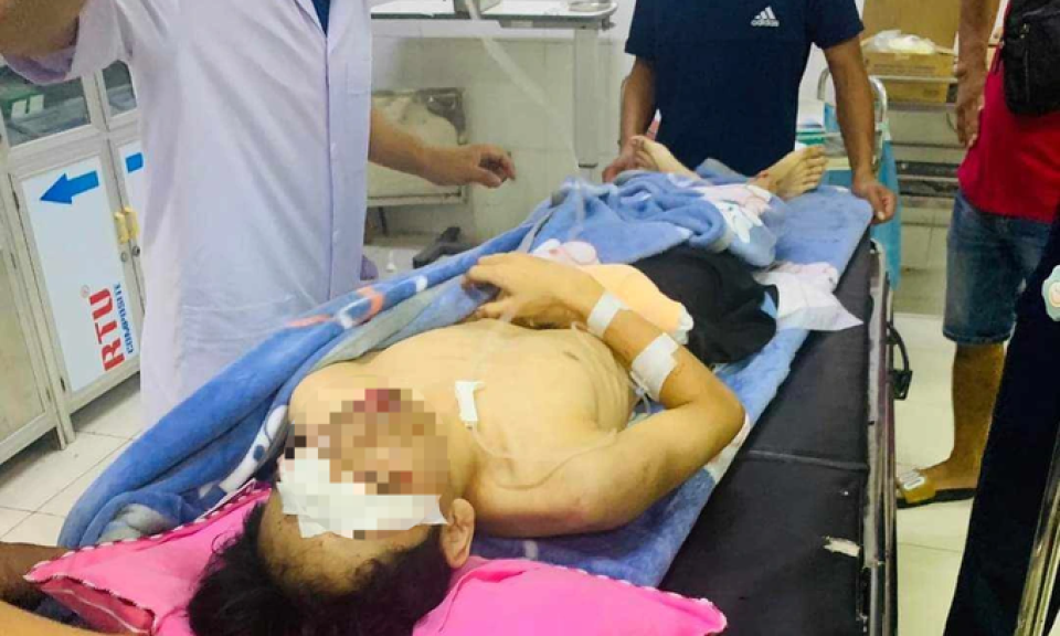Nam sinh dập nát tay, tổn thương mắt sau tiếng nổ lớn