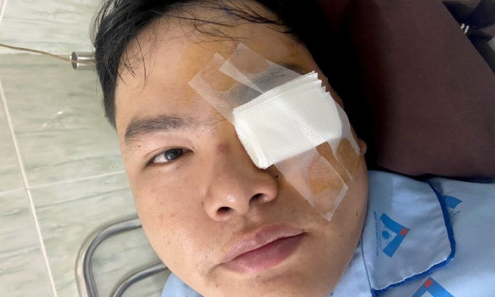 Xác minh vụ nam thanh niên tố bị gậy CSGT 'va' vào mắt