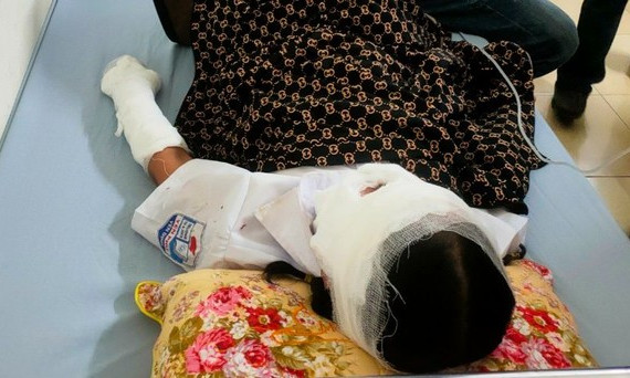 Nguyên nhân bất ngờ vụ bóng bay phát nổ trong ngày khai giảng khiến 10 học sinh bị bỏng