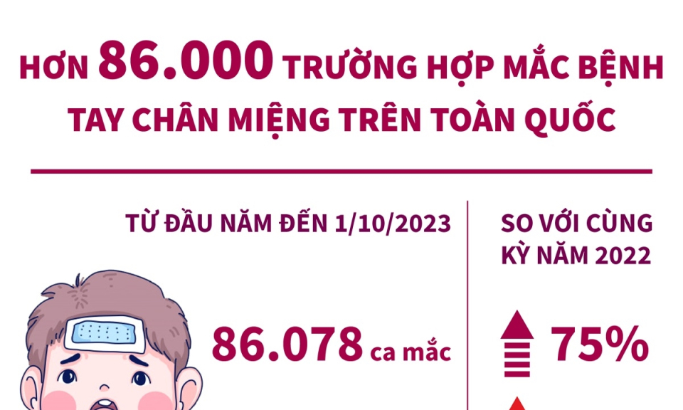 Số ca mắc bệnh tay chân miệng tăng tới 75% so với năm trước