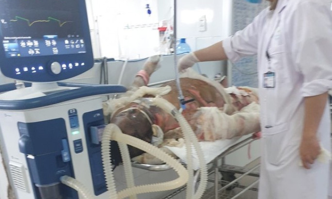 Người cha tự đâm mình tử vong sau khi đốt nhà khiến con chết cháy
