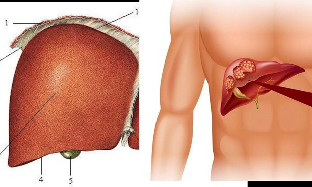 5 cách tăng tuổi thọ cho gan