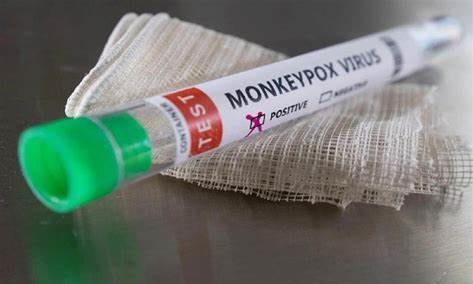 Phát hiện ca đậu mùa khỉ đầu tiên ở miền Tây