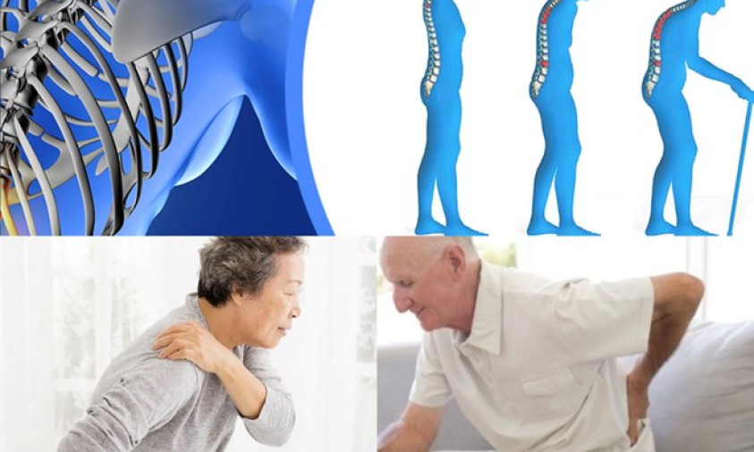 Những thực phẩm bạn nên tránh khi bị loãng xương