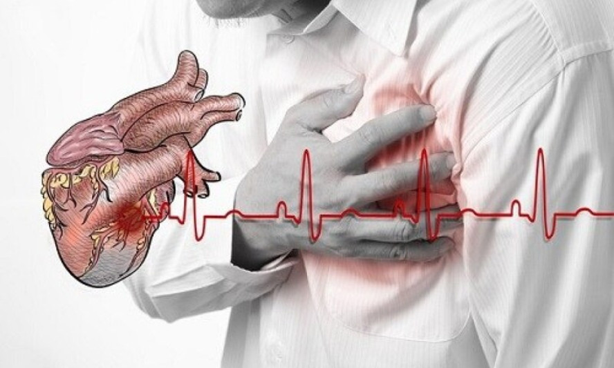 Ngoài cơn đau thắt ngực, 4 dấu hiệu cảnh báo nhồi máu cơ tim cấp ai cũng nên biết