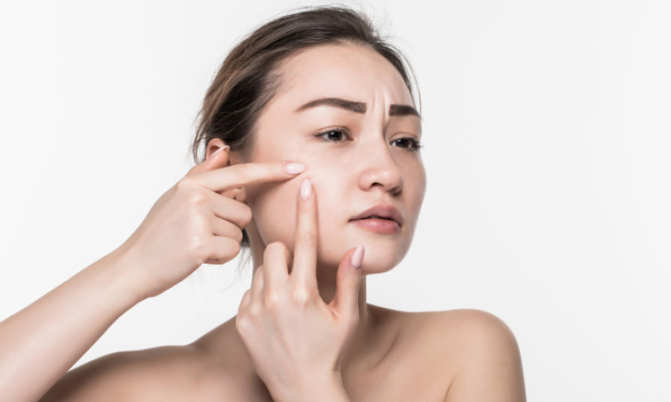 Dấu hiệu mụn cảnh báo ung thư