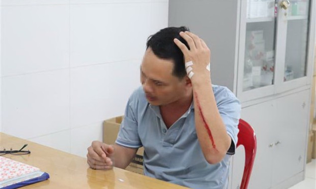 Bình Phước: Một điều dưỡng bị người nhà bệnh nhân hành hung