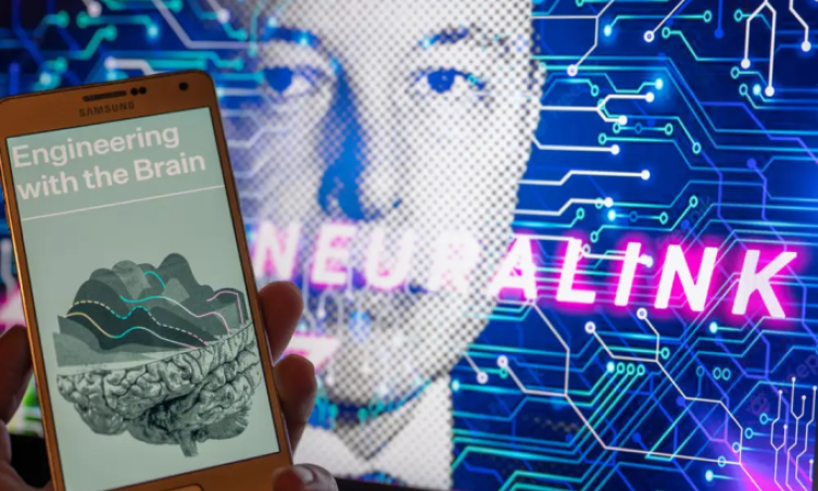 Hàng nghìn người đăng ký cấy chip não của Neuralink