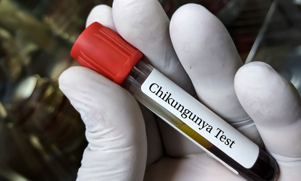 Mỹ phê duyệt vaccine đầu tiên trên thế giới ngừa virus Chikungunya