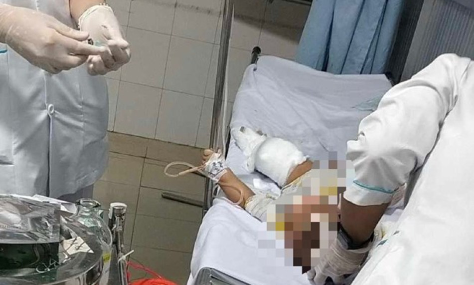 Ném bom xăng vào nhà khiến 3 người bị thương