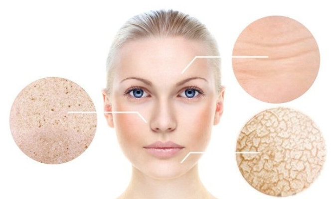 8 bước làm mềm da khô đơn giản khi thời tiết lạnh
