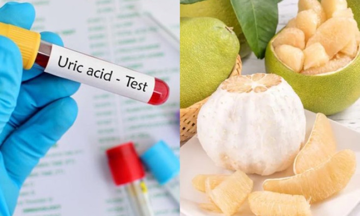 Tác dụng của ăn bưởi tới người có chỉ số axit uric cao
