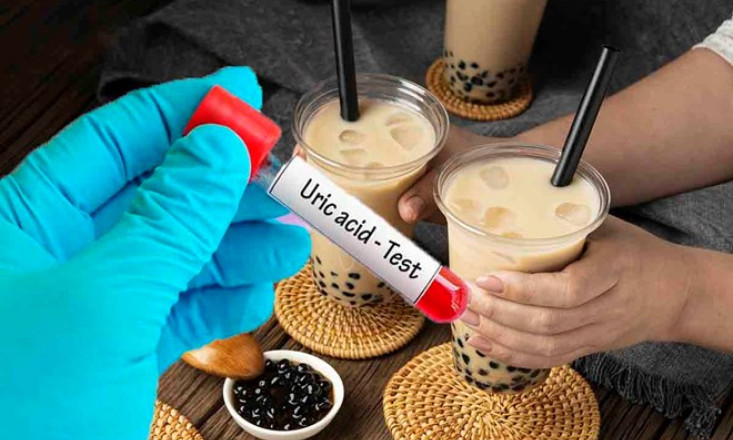 Tác động của trà sữa với người có chỉ số axit uric cao