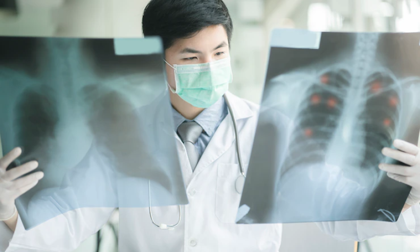 Ung thư di căn vị trí nào đáng sợ nhất?