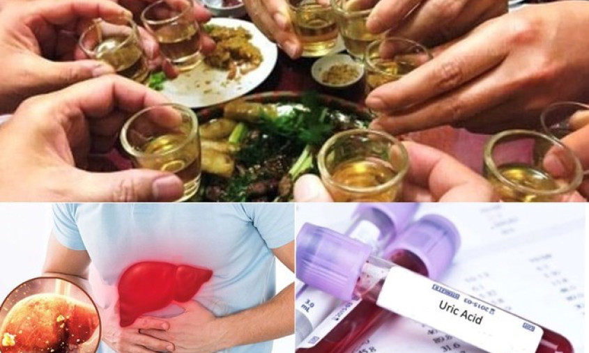 Chế độ ăn kiêng cho người bị bệnh gút