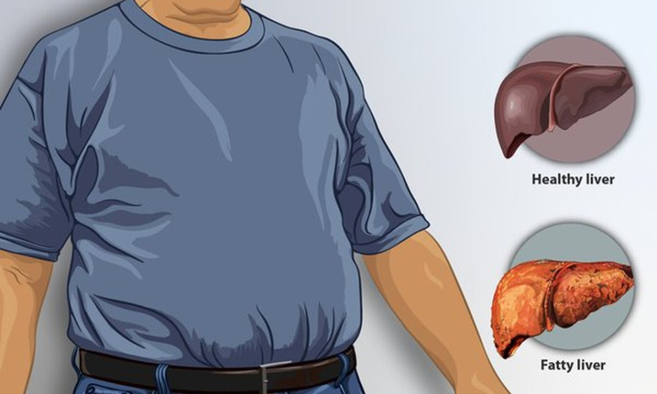 Cách nhanh nhất để phục hồi gan của bạn
