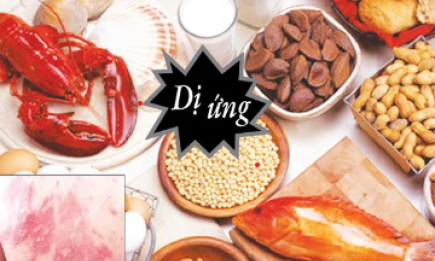 Người bị dị ứng thực phẩm có thêm thuốc điều trị mới