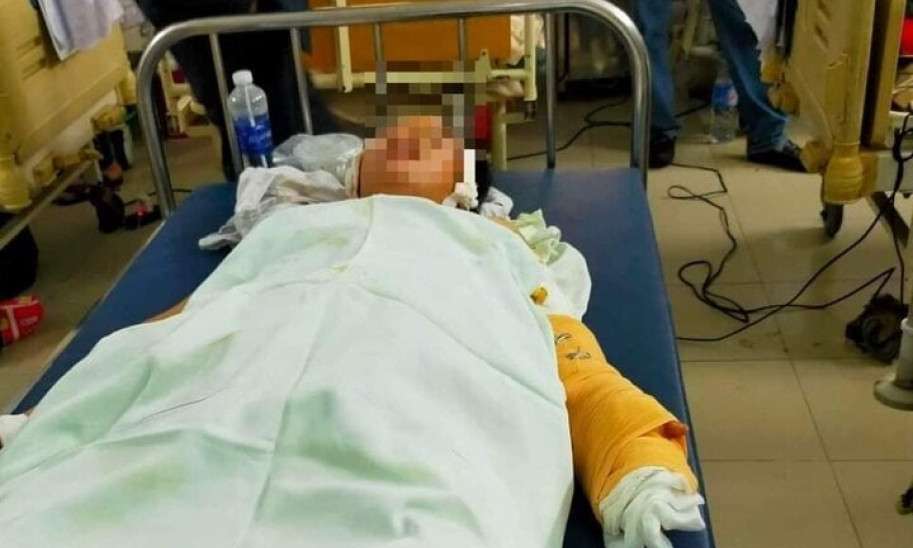 Bắt kẻ đâm trọng thương 2 mẹ con người yêu, phóng hỏa đốt nhà