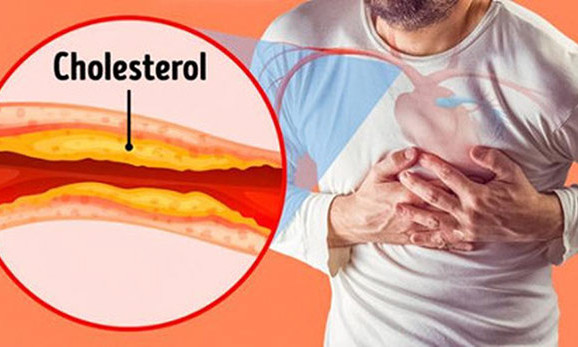 4 loại thực phẩm tốt nhất giúp giảm mức cholesterol
