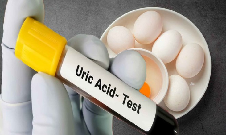 Lợi ích của việc ăn trứng đối với người axit uric cao