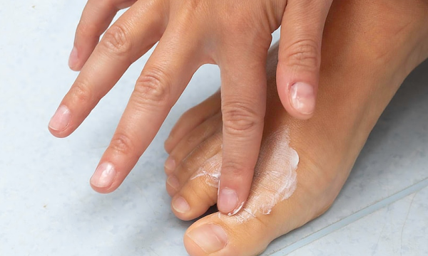 4 bệnh nấm da dễ gặp khi mùa mưa đến