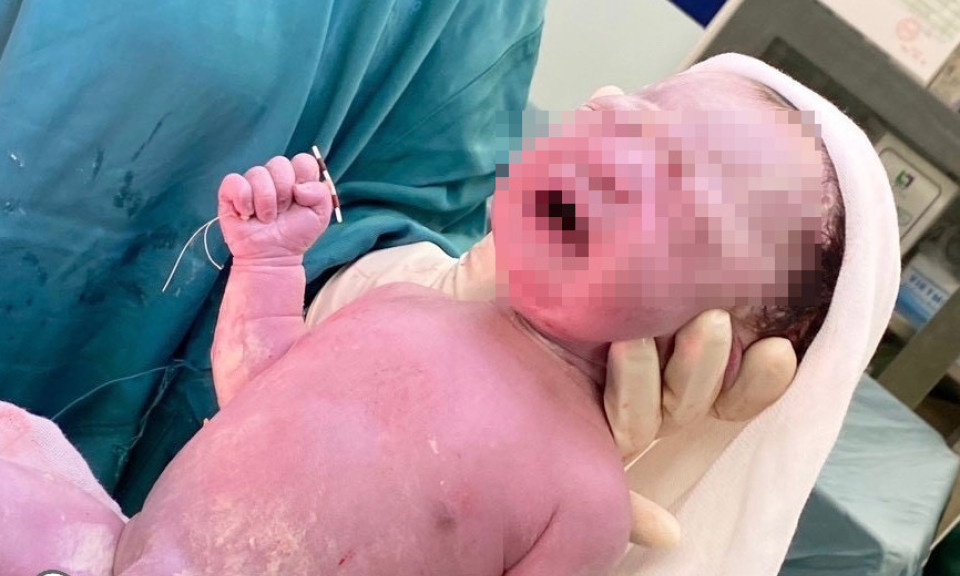 Hai em bé chào đời cùng với vòng tránh thai của mẹ