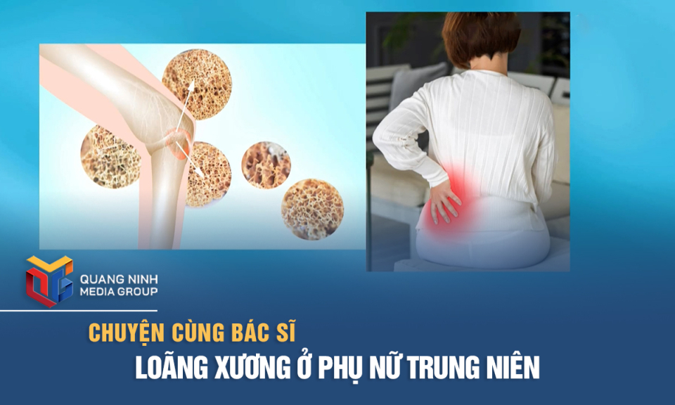 Loãng xương ở phụ nữ trung niên