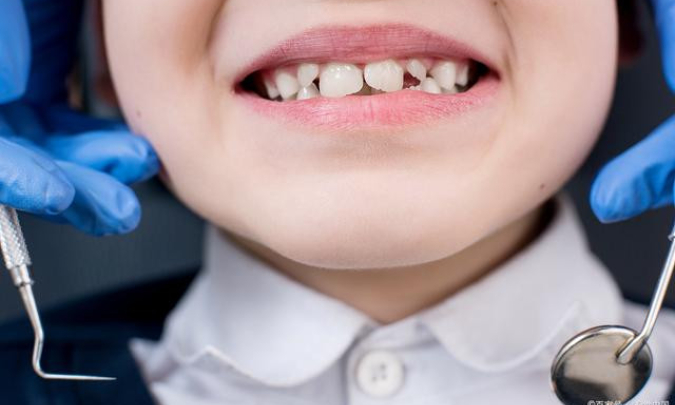 Trẻ em nên khám chữa răng từ lúc nào?