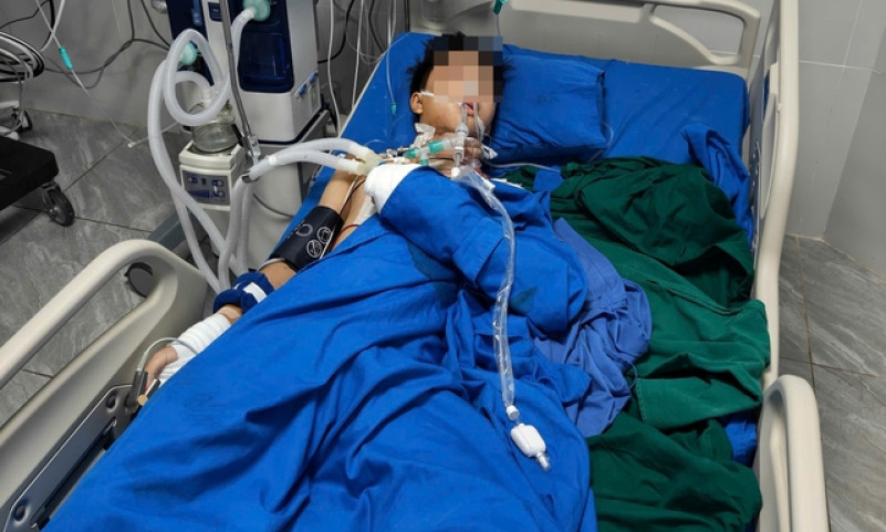 Tự chế tạo pháo, học sinh lớp 10 bị nổ nát bàn tay
