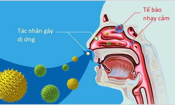 Mùa hanh khô phòng viêm mũi dị ứng tái phát