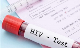 Brazil: 6 người nhiễm HIV sau khi cấy ghép tạng