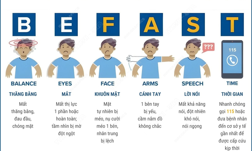 BE FAST - dấu hiệu nhận biết những triệu chứng của bệnh đột quỵ