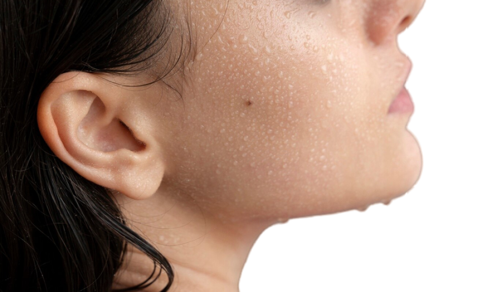 Đổ mồ hôi quá nhiều là dấu hiệu của bệnh gì?