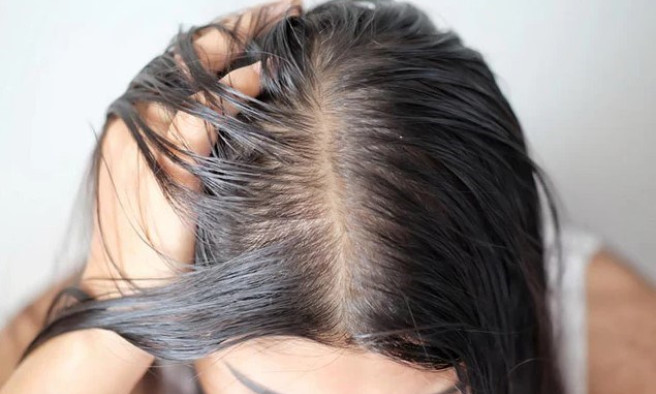 Mẹo hay khắc phục tóc bết vào mùa đông