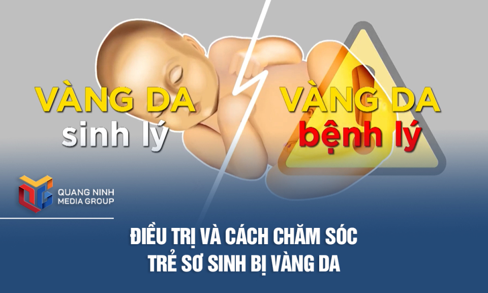 Điều trị và cách chăm sóc trẻ sơ sinh bị vàng da