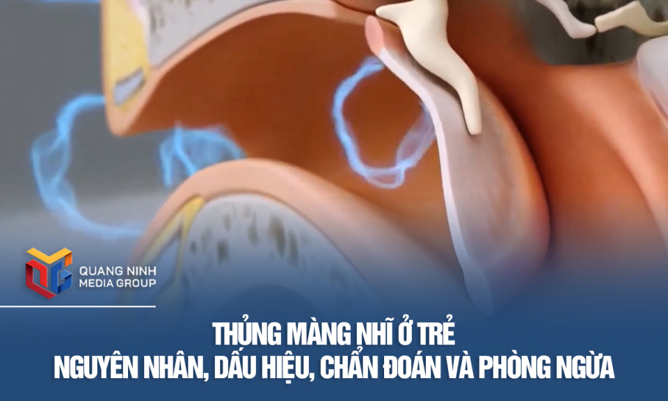 Thủng màng nhĩ ở trẻ - Nguyên nhân, dấu hiệu, chẩn đoán và phòng ngừa